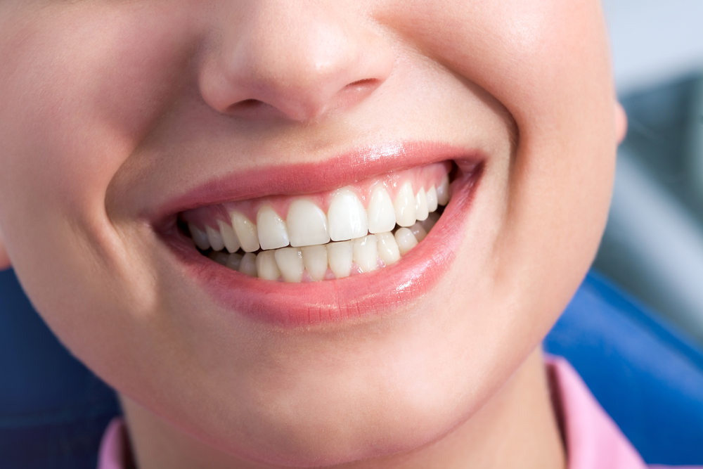 Five Signs You May Have Gum Disease - Docklands Dental Studio
